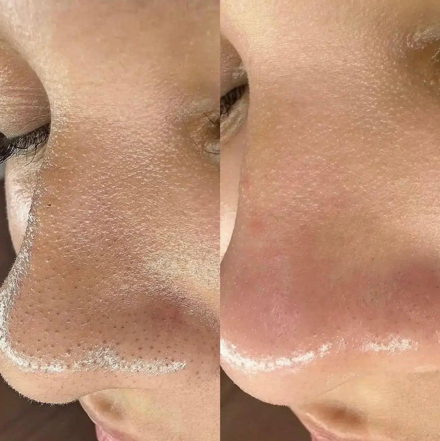 El Dúo Coreano Que Transforma Tu Piel en Solo 7 Días — Dr Melaxin Duo