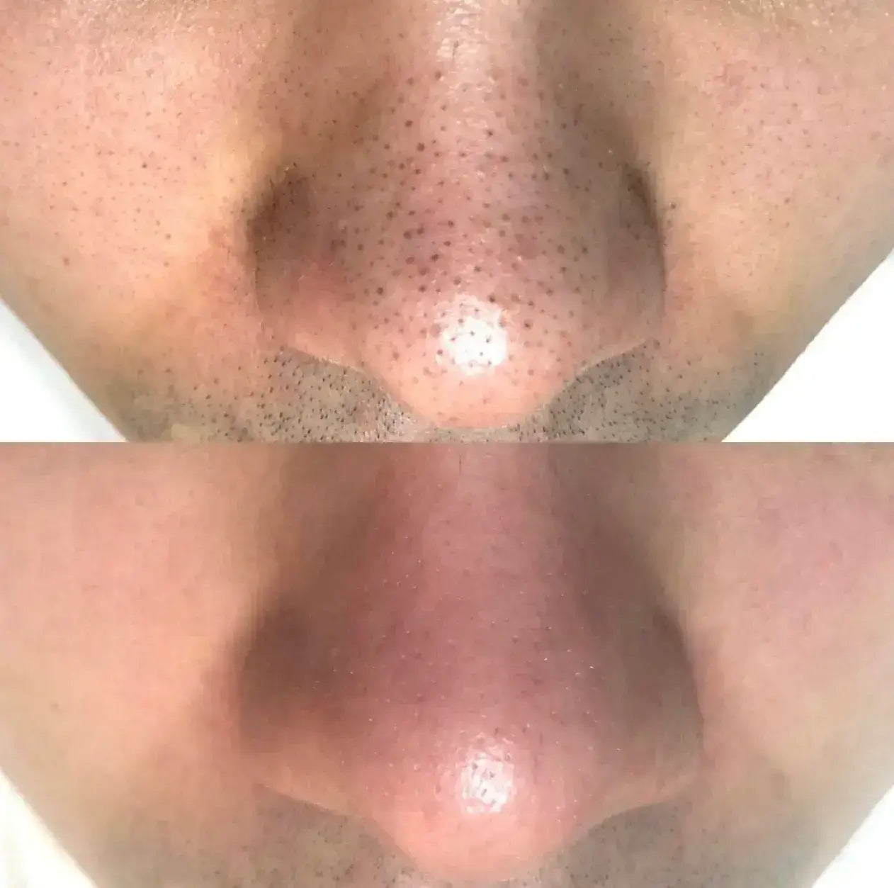 El Dúo Coreano Que Transforma Tu Piel en Solo 7 Días — Dr Melaxin Duo